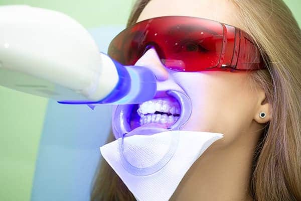 Laser teeth whitening treatments Portsmouth