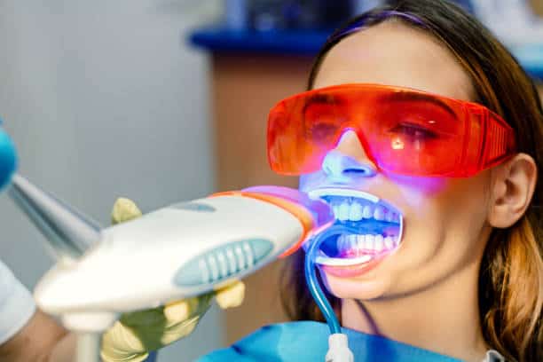 Simplifying Teeth Whitening: A Comprehensive Guide Portsmouth