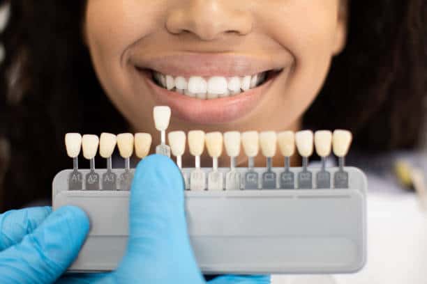 Laser Teeth Whitening: Exploring the Longevity of Your Brighter Smile Portsmouth