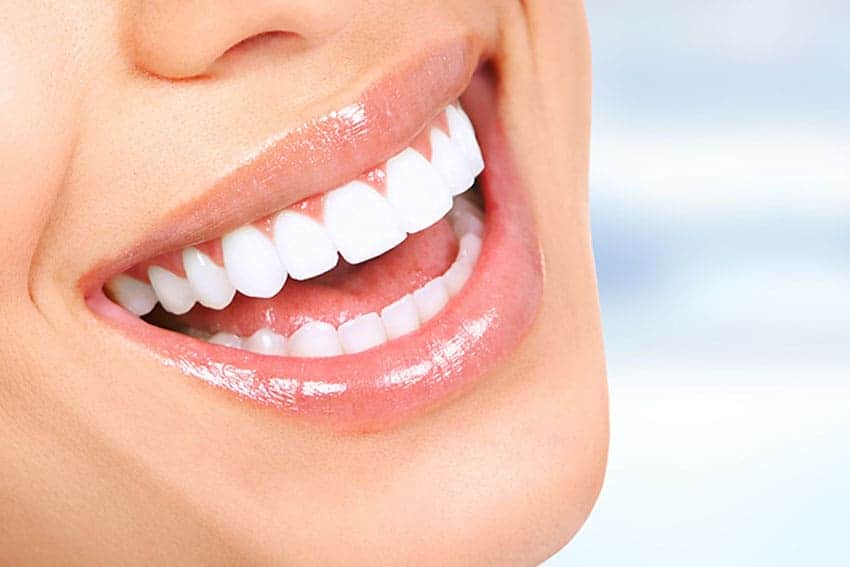 Teeth Whitening Abingdon Portsmouth