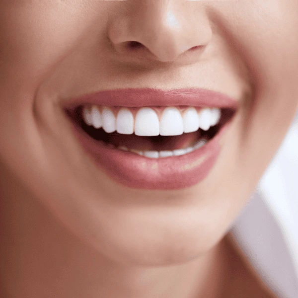 Get A whiter smile fast! Book with LA Teeth Whitening today! Portsmouth